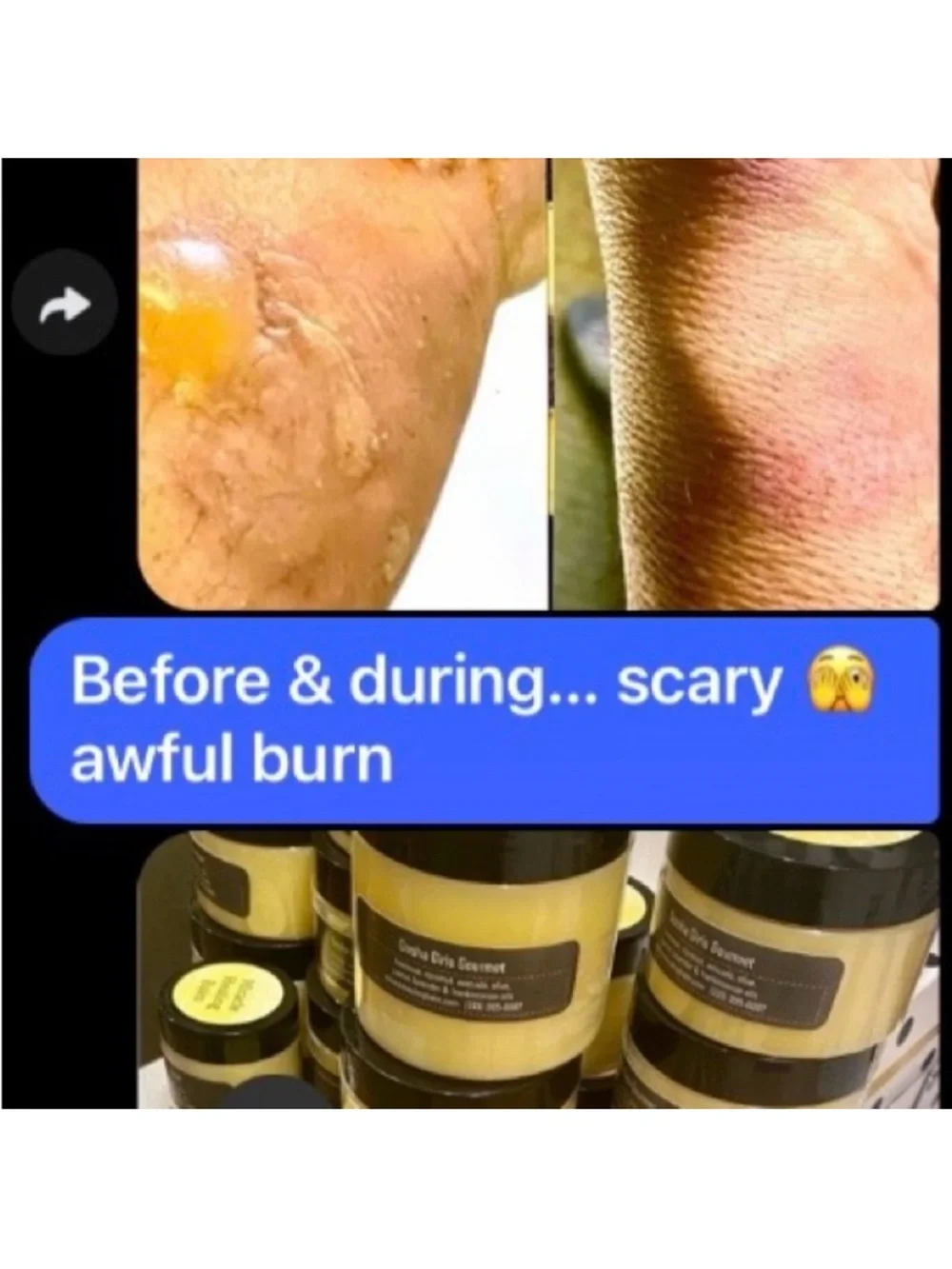 GOSHA GIRLS REMEDIES miracle healing
